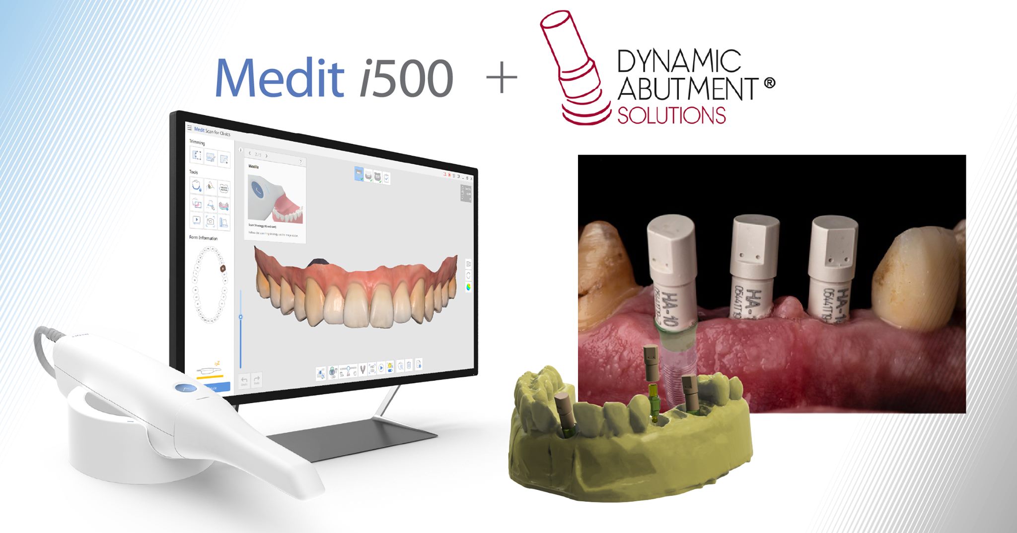 Medit i500 scanner has been validated for Dynamic Abutment solutions